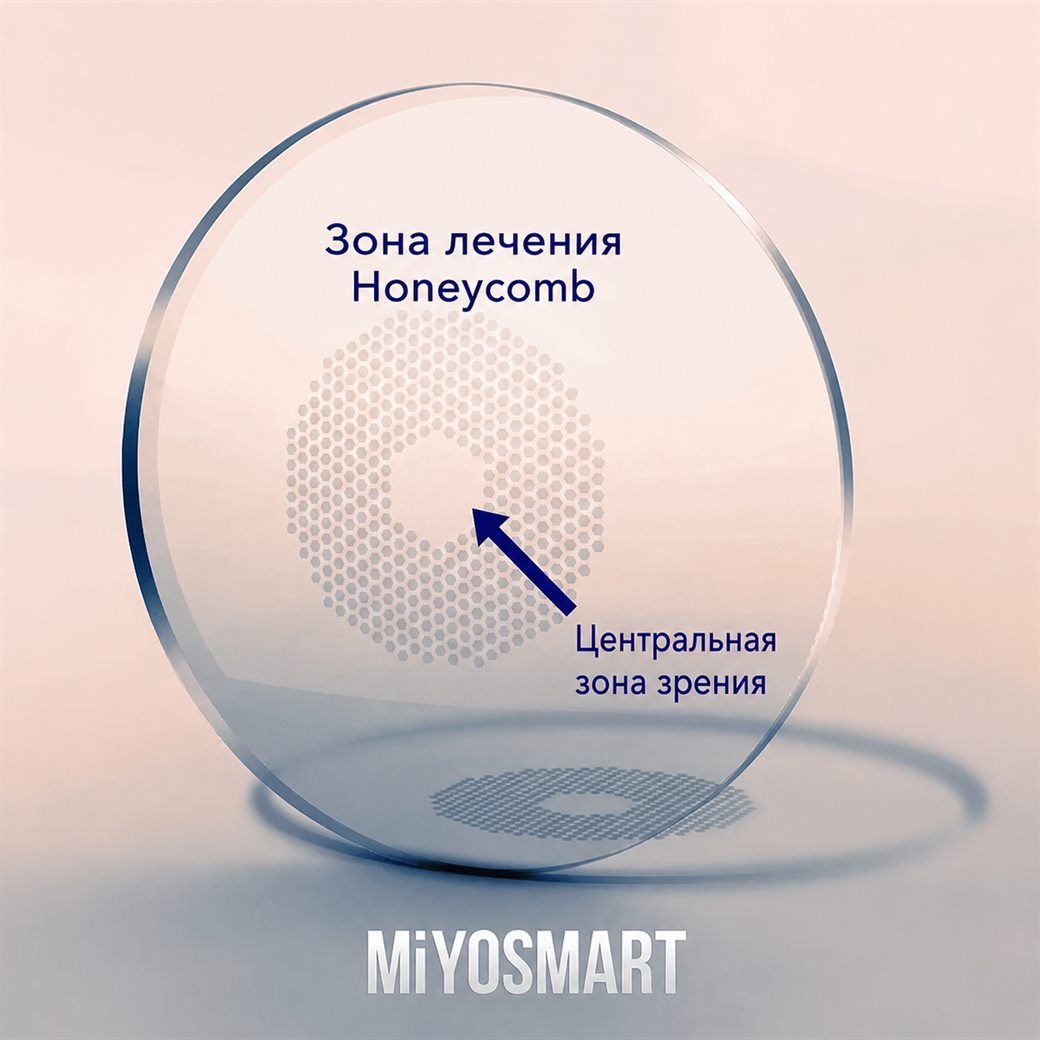 Дефокусная линза: чёткий центр и лечебная периферия с зонами дефокуса